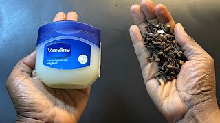 Mix cloves with Vaseline  A secret nobody will never tell you  thank me later [upl. by Derwin]