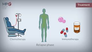 What is myeloma [upl. by Marlena]