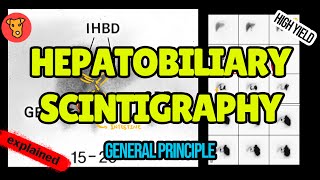 Hebatobiliary Scintigraphy Explained HIDA scan [upl. by Ennaitsirhc518]