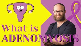 What is adenomyosis of uterus Symptoms and Treatment [upl. by Malena]