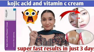 kojic acid and vitamin c cream  kojic acid vitamin c cream  kojic acid and vitamin c cream review [upl. by Drugge]