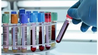 Collection of blood specimens for lab test practice for a nurse [upl. by Lovett]