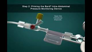 IntraAbdominal Pressure Monitoring [upl. by Zohara766]