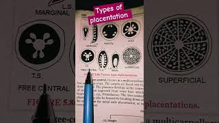 Types of Placentation botany sciencesolvers ytshort [upl. by Otsugua498]