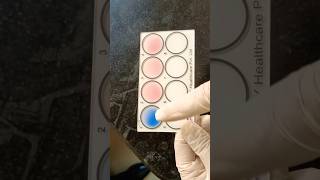 WIDAL TEST PART 2 hospital science lablife doctor labrador machine technology lab [upl. by Gehman]