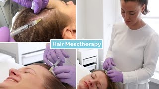 Hair Loss Mesotherapy  The Laser and Skin Clinic [upl. by Lena]