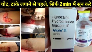 Xylocaine 2 injection lignocaine 2injection use or side effects in hindi [upl. by Hermina]