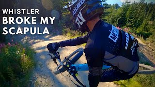 The Most Painful Crash of my life  Whistler Bike Park Accident [upl. by Laura]