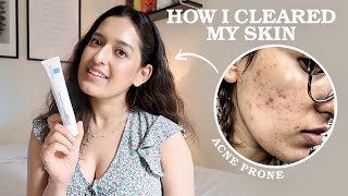 My 3 Step EvidenceBased Skincare Routine As A Doctor  HOW I CLEARED MY ACNE  Affordable Easy [upl. by Malena]