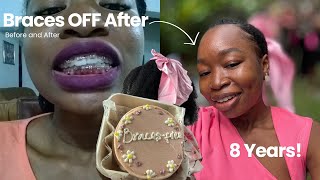 After 8 Long Years… My Braces Are Finally Coming Off 🥳  Braces Removal Journey [upl. by Etnahc]