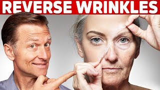 How To Reverse Wrinkles  – DrBerg on Anti Aging Hormones [upl. by Hajile]