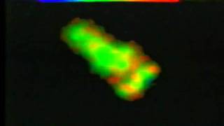 Chemotaxis and Phagocytosis in Human Neutrophils [upl. by Cilurzo793]