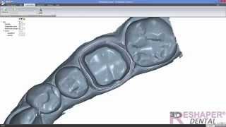 Création de modèles de travail avec 3DReshaper Dental [upl. by Ttayh]