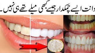 Teeth Whitening at Home  100 Bright Yellow Teeth Naturally with Simple Home Remedy Urdu Hindi [upl. by Ynolem]