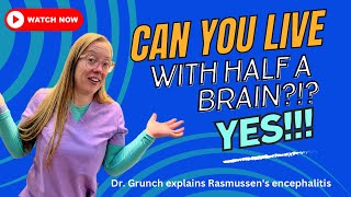 Dr Grunch explains Rasmussens encephalitis [upl. by Aruasor]