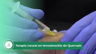 Terapia neural en tenosinovitis de Quervain [upl. by Felike]