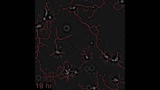 VideoOfTheDay SLIM imaging and analysis of neuronal network formation [upl. by Eidak]