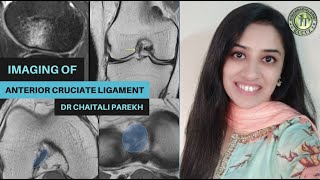 IMAGING OF ANTERIOR CRUCIATE LIGAMENTS  DR CHAITALI PAREKH  MRI KNEE  SEGONDS FRACTURE  ACL TEAR [upl. by Cirilo]