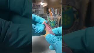 Please subscribe orthodontics good satisfying orthodontist simple [upl. by Burty]