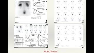 Renal Scintigraphy [upl. by Troxell]