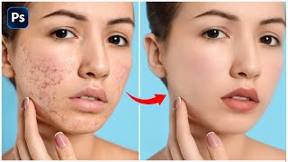 Skin Retouching 2024  HighEnd Face Retouching  Best Photoshop Tutorial [upl. by Noral]