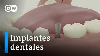 Implantes dentales ventajas e inconvenientes [upl. by Nemzaj]