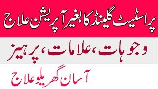 How to treat Enlarge prostate Gland with out operation in urdu and hindi [upl. by Ivens]