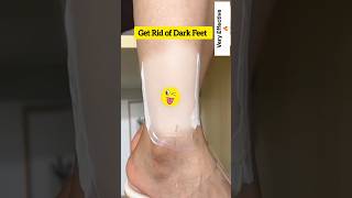 🔥Get Fair Feet amp Ankle InstantlyFair Feet In Just 5 Minutes 😱Most Easy Pedicure shorts video diy [upl. by Carolyn900]