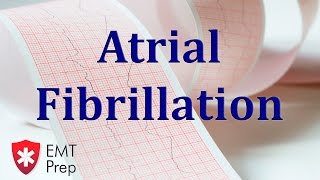 Atrial Fibrillation ECG  EMTprepcom [upl. by Attalanta778]