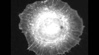 Adaptive rheology and ordering of cell cytoskeleton govern matrix rigidity sensing [upl. by Carlton]