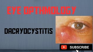 Dacryocystitis  Causes Symptoms Treatment [upl. by Neely]