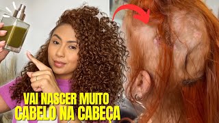 🚨CABELO CRESCE EM 10 DIAS  CRESCIMENTO ACELERADO COM APENAS 2 INGREDIENTES hair transformation 🔥 [upl. by Nerehs]