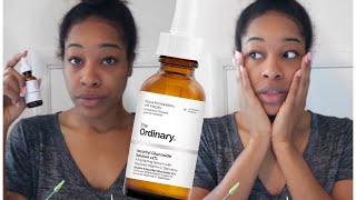 THE ORDINARY VITAMIN C  ASCORBYL GLUCOSIDE  BRIGHTENING SERUM  APPLYING TO SKIN  REVIEW [upl. by Tuchman583]