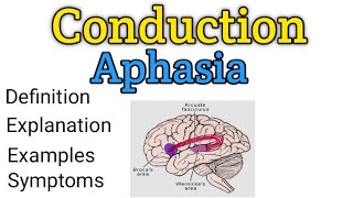 Conduction aphasia  What is Conduction aphasia  What is aphasia  Aphasia  Arcuate fasciculus [upl. by Ahsiad374]