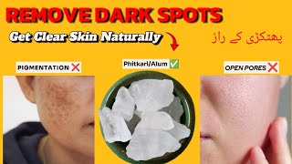 Fitkari ke fayde Get Clear and spotless skin How to use Phitkarialum Say Goodbye to Dark spots 💯 [upl. by Suirtemed]