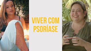 Psoríase conhecimento é a chave para uma vida livre de lesões [upl. by Thirza]