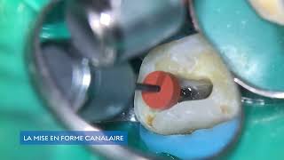 Le flux endodontique Henry Schein Edge Endo et BA International [upl. by Nolahp]