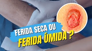 Ferida seca ou ferida úmida [upl. by Cirri]