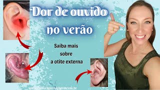 Dor de ouvido no verão saiba mais sobre a otite externa [upl. by Tadashi806]