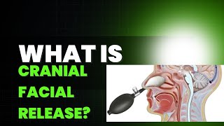 What is cranial facial release [upl. by Nothgiel65]