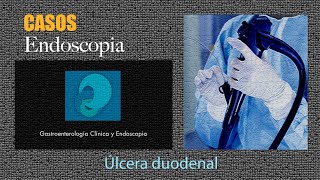 Úlcera duodenal [upl. by Wilfreda]