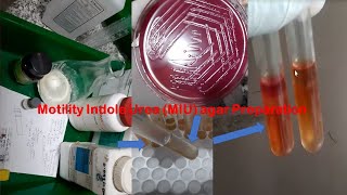 MIU Test Medium Preparation in Laboratory and inoculation of Test organism [upl. by Iramat]