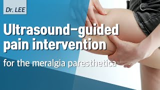 TAnatomy and US guided pain intervention for the meralgia paresthetica PRF treatement [upl. by Terris]