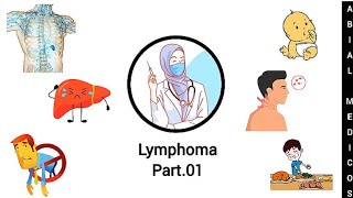 Lymphoma  Hodgkins lymphoma  Sign and symptoms  Diagnosis  Treatment [upl. by Lindemann]