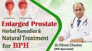 Enlarged Prostate Herbal Remedies amp Natural Treatment for BPH [upl. by Arenat747]