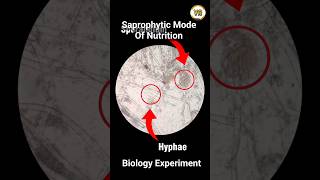 Growth of Rhizopus Fungi  Saprophytic Mode of Nutrition  Experiment based Learning [upl. by Yenobe]