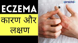 Eczema एक्जिमा Causes Symptoms amp Types  Atopic amp Seborrheic Dermatitis Symptoms Hindi Practo [upl. by Adnilreh435]