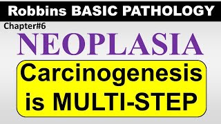 Chp6Part5 Robbins Basic Patho  CARCINOGENESIS A Multi step Process General Pathology Neoplasia [upl. by Seppala]