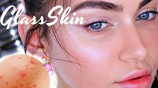 How To Glass Skin For Acne Pimple Prone Skin  Ruby Golani [upl. by Niltak623]