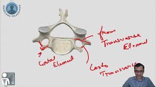 Typical Cervical Vertebrae [upl. by Ailama]